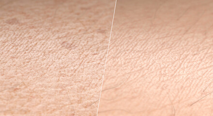 Skin surface young and old aging comparison macro