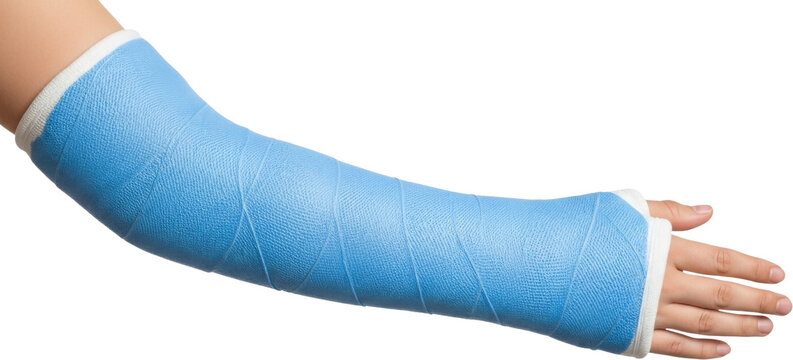 Close-up of a human arm wrapped in a white medical cast, extending from the upper arm to the fingers, suggesting a broken or fractured limb being treated and stabilized. Transparent Background