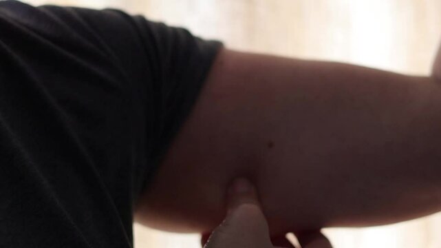 Un primer plano de una mujer blanca mayor de 50 a&ntilde;os toc&aacute;ndose el exceso de grasa del brazo, tiene la piel con flacidez por perdida de peso