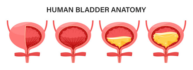 Human bladder empty and full, urinary system. Human bladder internal organ anatomy. Vector illustration.