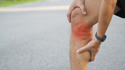 Varicose veins on the legs of men