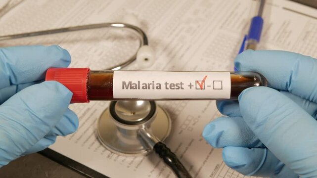 Doctor holding positive malaria blood test tube