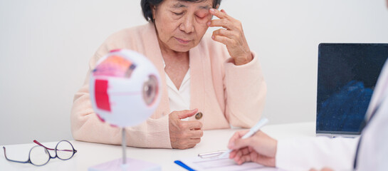 Elderly Patient consulting Doctor to Eye disease, Senior Medical Diagnosis. Anatomy Eye model for...