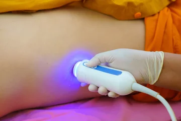 Closeup of man getting an fibroscan or ultrasound scan on abdominal by doctor of the liver revealed for liver stiffness, liver steatosis, fibrosis reading. Ultrasound elastography © CasanoWa Stutio