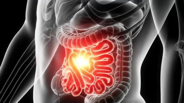 Inflamed intestines highlighted in a 3D anatomical rendering of the human digestive system.
