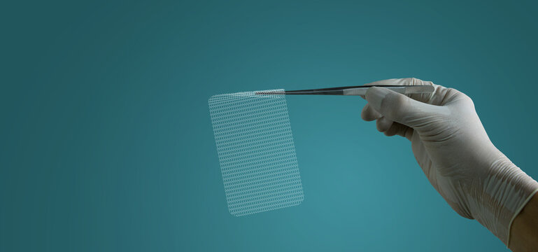 surgical mesh