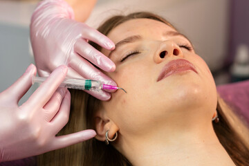 Aesthetician applying curved-needle facial peel care on patient. Chemical Peel Face Treatment for woman face at beauty clinic. Non-traumatic procedure facial rejuvenation. PRX-T33 peeling