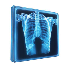 Chest X Ray Illustration Medical imaging radiology rib cage bones anatomy on transparent background