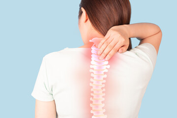Woman suffering from back pain and neck pain with anatomy of spine and xray for diagnosis over blue background. Common causes include injuries like inflammation of muscle ache or spinal stenosis.