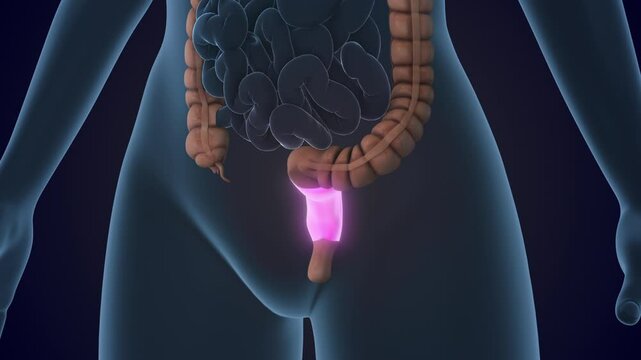 The Rectum is a section of the large intestine