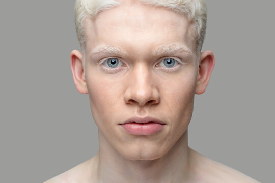 Close up portrait of albino man, blue eyes, white hair, grey background, high detail. 5000 px