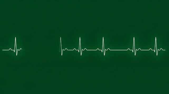 Green background with light colored heart rate monitor patterns