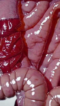 Vertical screen, parasitic roundworm ascaris lumbricoides crawling through human small intestine, illustrating intestinal parasite behavior with detailed microscopic view against white background