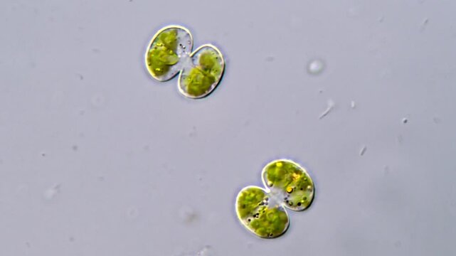 Cosmarium algae cells under microscope, 1000x magnification 