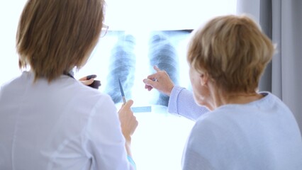 Obraz premium Female doctor pointing at radiography while explaining diagnosis to senior patient in hospital room, illustrating healthcare and medical concepts with clarity and compassion