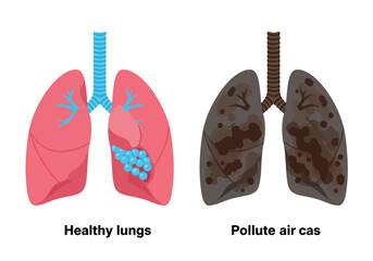Comparison of healthy lungs and lungs damaged by polluted air