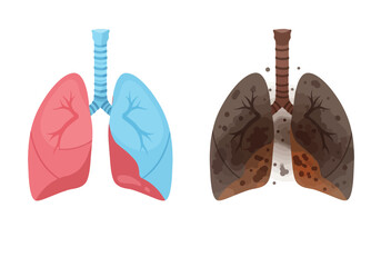 Two lungs one healthy red and blue the other damaged brown with spots
