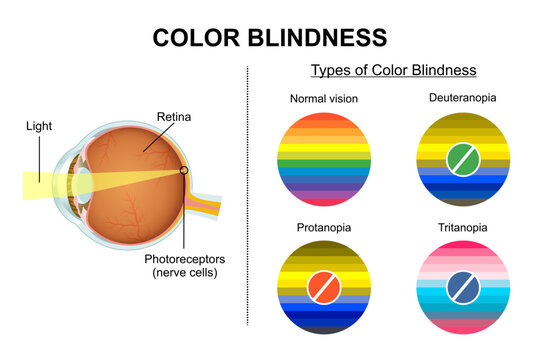 Color Blindness and its testing types illustration
