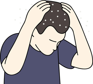 비듬 남