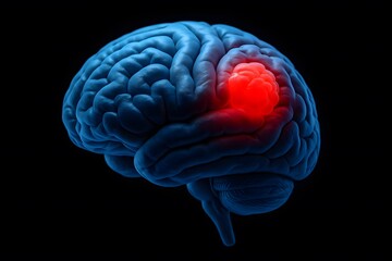 Understanding Brain Tumors A Visual Guide to Diagnosis and Treatment