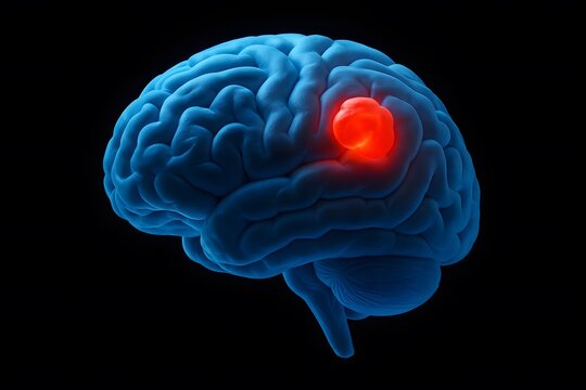 Understanding Brain Tumors A Visual Guide to Diagnosis and Treatment