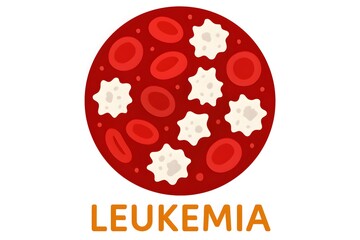 Understanding Leukemia Blood Cells, Diagnosis, and Treatment Options