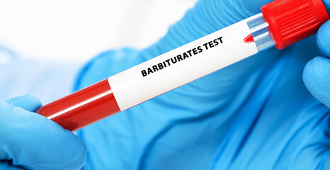 Barbiturates Test