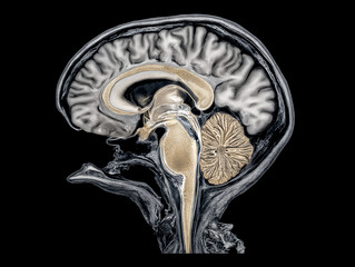 Hippocampus MRI scan. High-res brain scan focused on hippocampus for medical analysis.