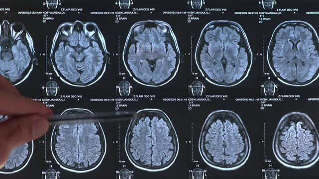Close up view of CT scan image human brain. 4k footage.