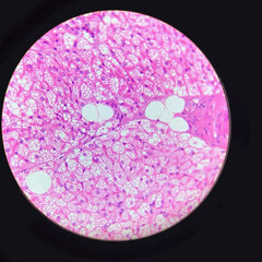 Micrograph of stellate hepatic cells