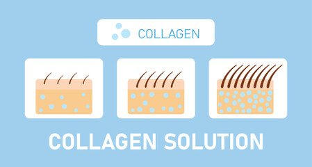 Collagen Solution, Hair Growth Stages Vector Infographic, Protection Skin