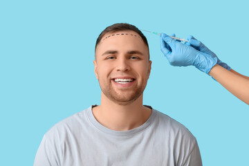Young man with hair loss problem and marks receiving injection on blue background