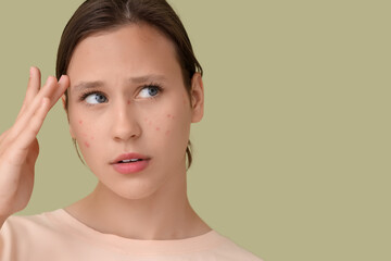 Beautiful young woman with acne problem on green background