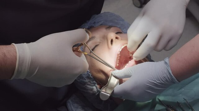 Professional works with suture in woman open mouth during surgical procedure. Retractors and forceps used to facilitate precise manipulation