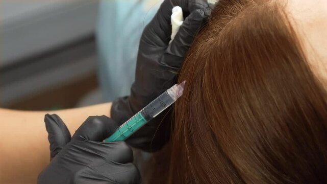 Close-up plasma injection procedure, hair growth stimulation. Cosmetologist injecting PRP into scalp to promote follicle regeneration. Aesthetic specialist performing hair restoration therapy using