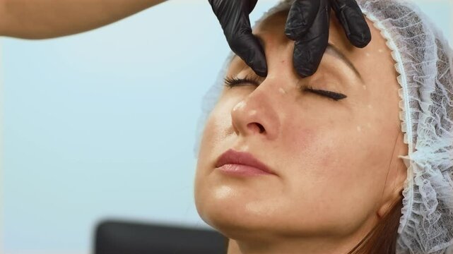 Doctor cosmetologist holding injection sites to stop blood and wiping with cotton sponge. Aesthetic specialist pressing puncture points for bleeding control and cleaning with cotton pad. Cosmetic