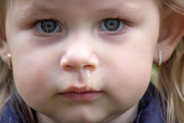 The little girl has snot. Spring allergies