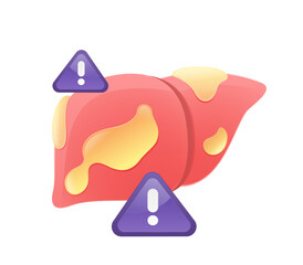 Fatty liver disease graphic: Organ with excess fat, showing health risks.