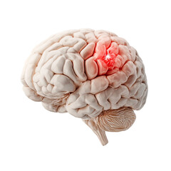 Human brain with red highlight indicating an issue on transparent background