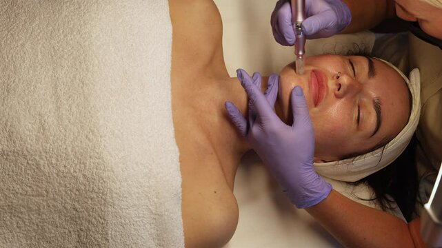 Woman receiving a professional microneedling treatment at a cosmetology clinic. A beautician in gloves is using a dermapen device on the client's face for skin rejuvenation and collagen stimulation