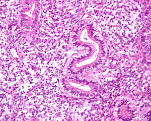 Human endometrial glands. Early secretory phase