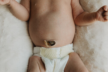 Close-Up of Newborn Baby Belly with Healing Umbilical Cord Stump and Diaper on Soft Blanket,...