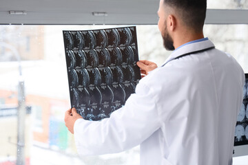 Male doctor studying MRI scan of spine near window in clinic, back view