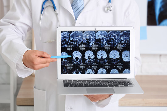 Male doctor showing laptop with MRI scan of head in clinic, closeup