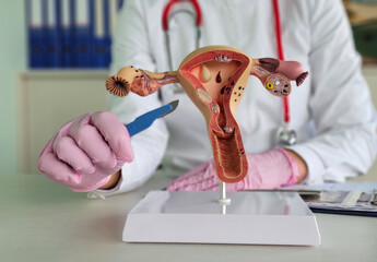 Reasons for uterine removal. Doctor scalpel uterus and surgery. Amputation of uterus and...