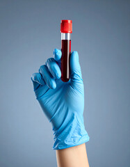 A gloved hand holds a test tube filled with blood against a plain blue background, highlighting a medical or laboratory setting