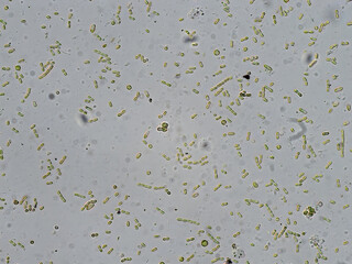 Diatoms under microscope in bright field view