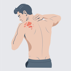 Autoimmune progesterone dermatitis,urticaria,Bullous pemphigoid,herpetiformis,Dermatomyositis,Epidermolysis bullosa acquisita,Gestational,Hidradenitis suppurativa,Lichen planus,Linear IgA,Psoriasis