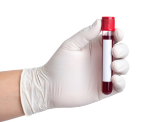 A gloved hand holds a blood sample vial with a red cap and a blank white label.