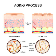 Aging process. Close-up of collagen and elastin fibers, fibroblasts.
